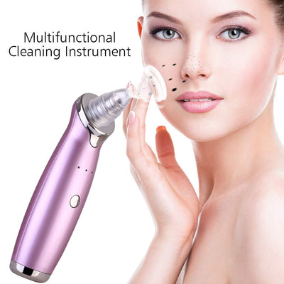 Advanced Pore Cleanser Vacuum – Blackhead Removal and Skin Exfoliation Tool