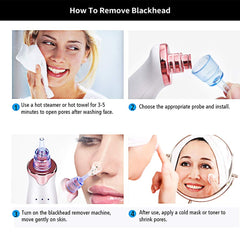 Advanced Pore Cleanser Vacuum – Blackhead Removal and Skin Exfoliation Tool