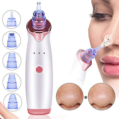 Advanced Pore Cleanser Vacuum – Blackhead Removal and Skin Exfoliation Tool